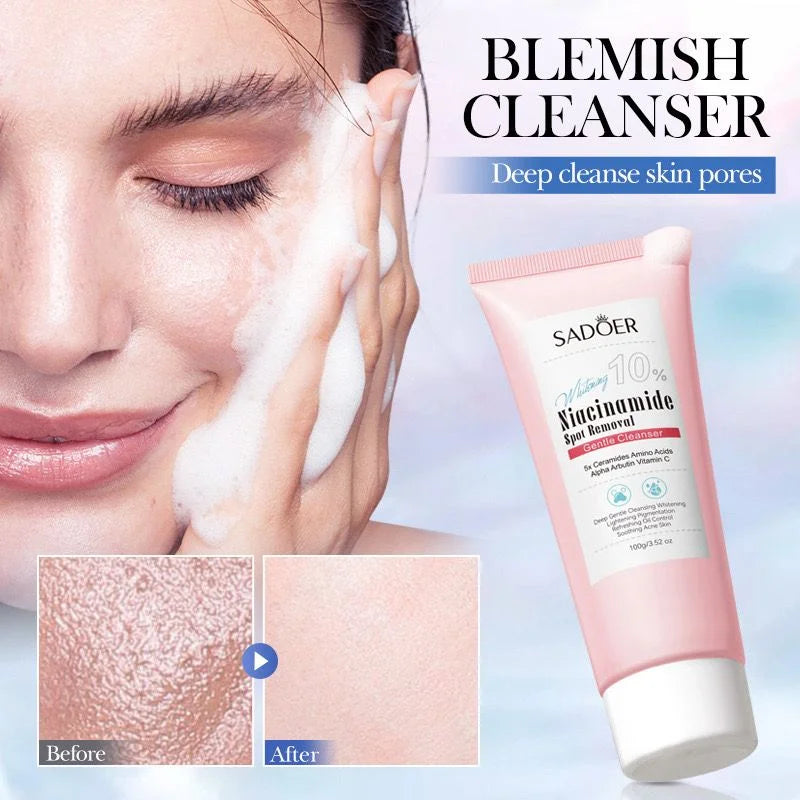 SADOER 10% Niacinamide Spot Removal Gentle Cleanser ( The Savings Spot Sale )
