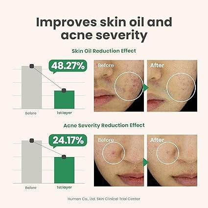 AXIS-Y The Spot Difference Blemish Treatment Serum