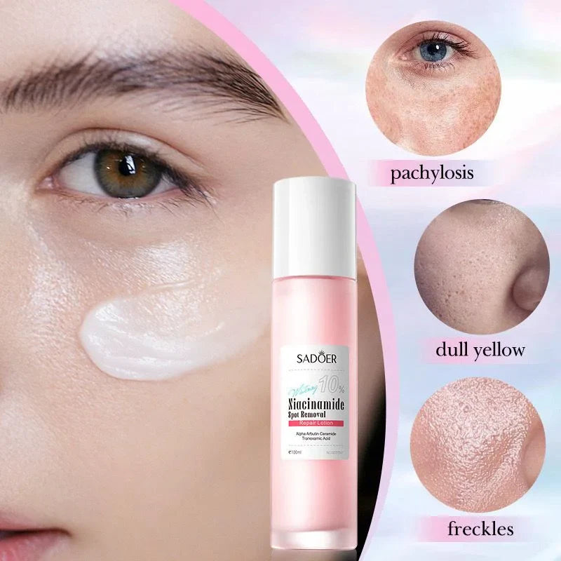 SADOER 10% Niacinamide Spot Removal Repair Lotion ( The Savings Spot Sale )