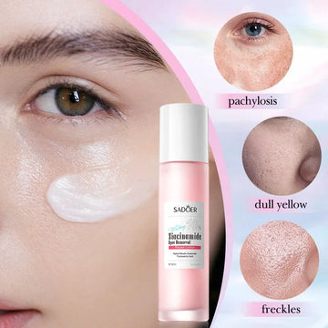 SADOER 10% Niacinamide Spot Removal Repair Lotion ( The Savings Spot Sale )